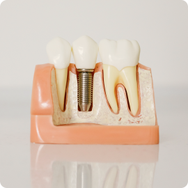 Prosthodontic